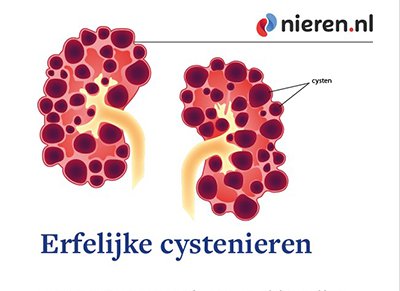 Erfelijke cystenieren Erfelijke cystenieren