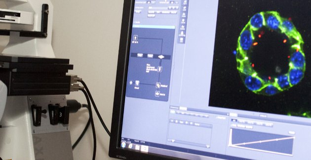 Computermonitor met blauw-groene foto erop.
